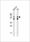 (Mouse) Gnl3 Antibody (C-term)